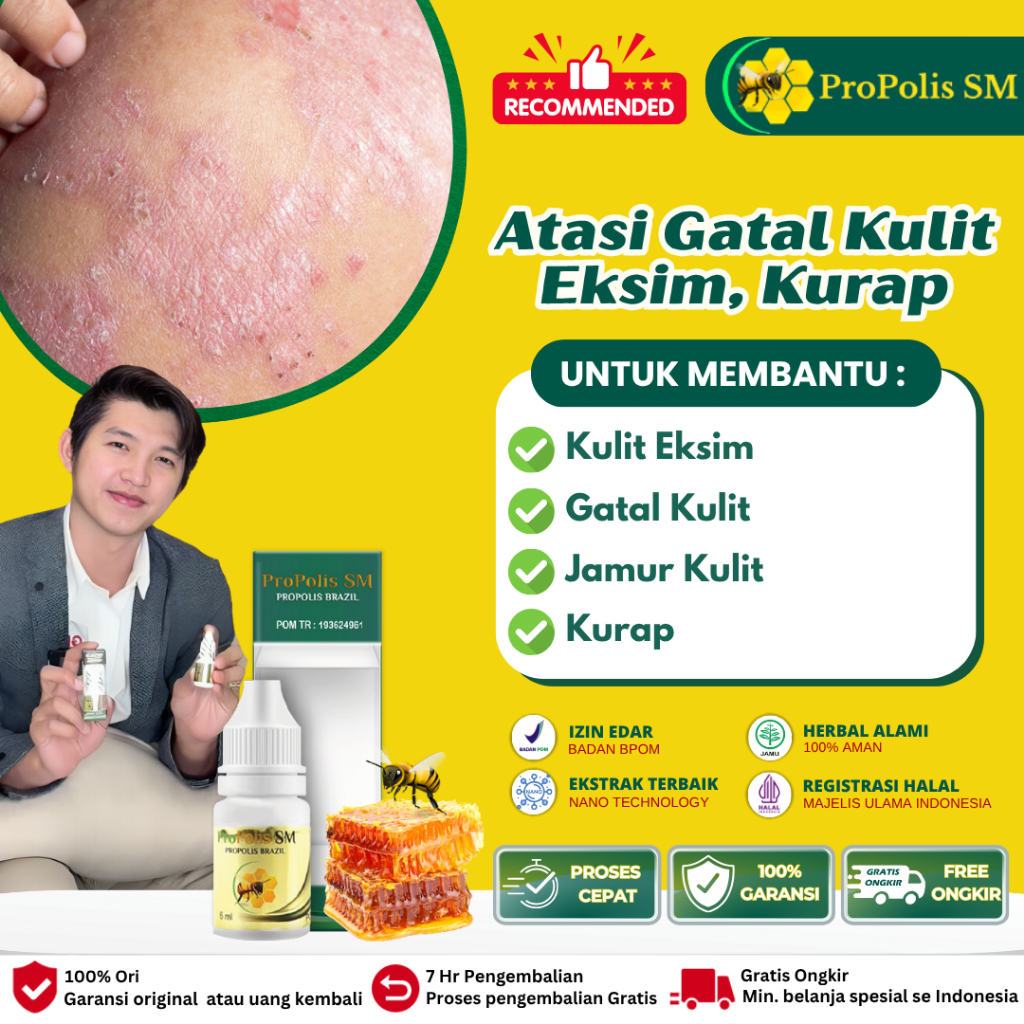 Obat Oles Kulit Eksim, Obat Eksim Kering Menahun, Obat Eksim Kering dan basah, Obat Eksim Kering Men