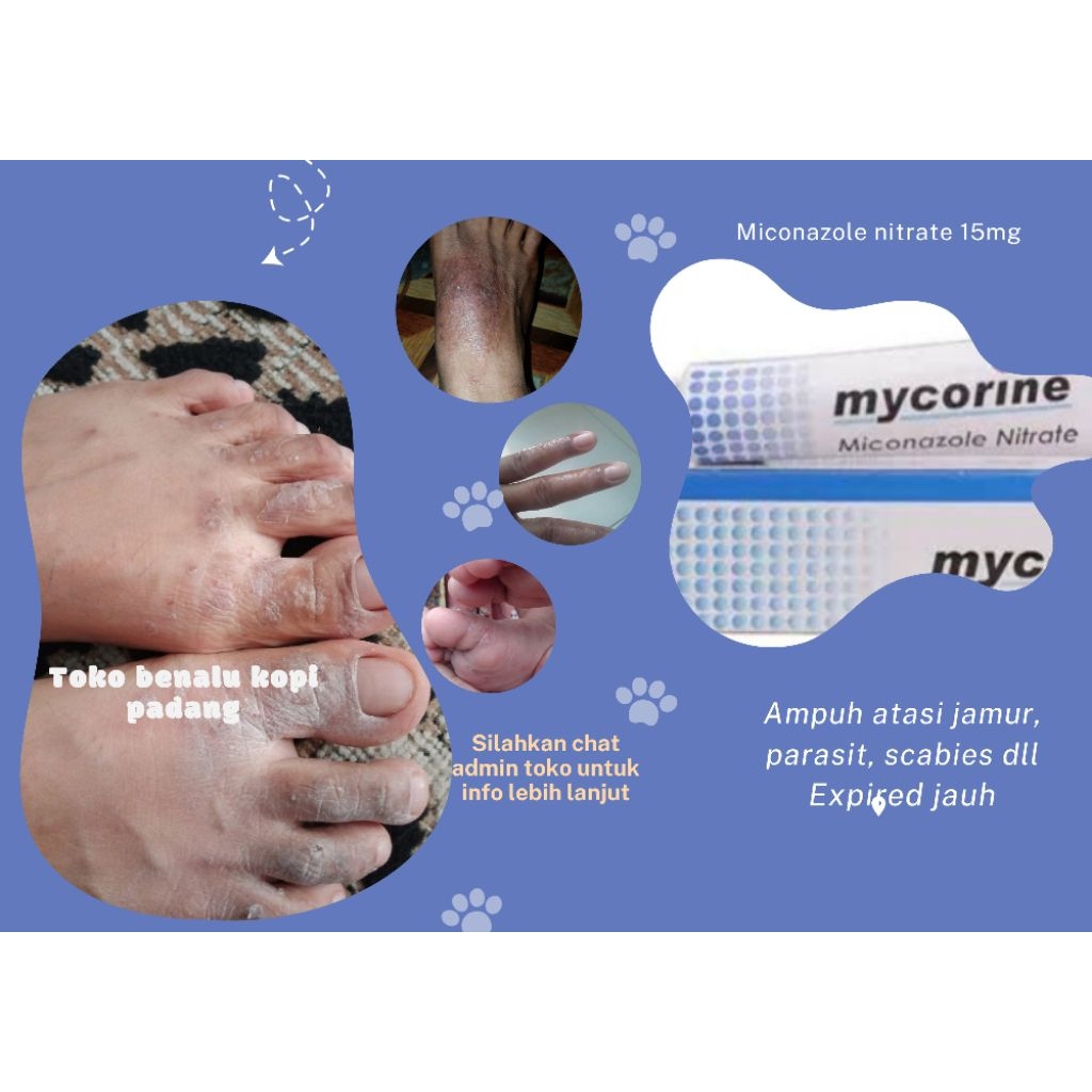 Mycorine 15gram salep ampuh jamur kurap eksim kutu air