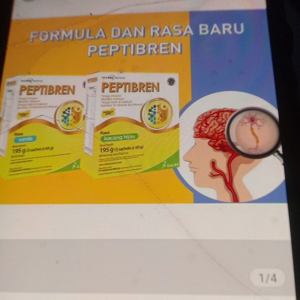Susu peptibren 210/195 gr