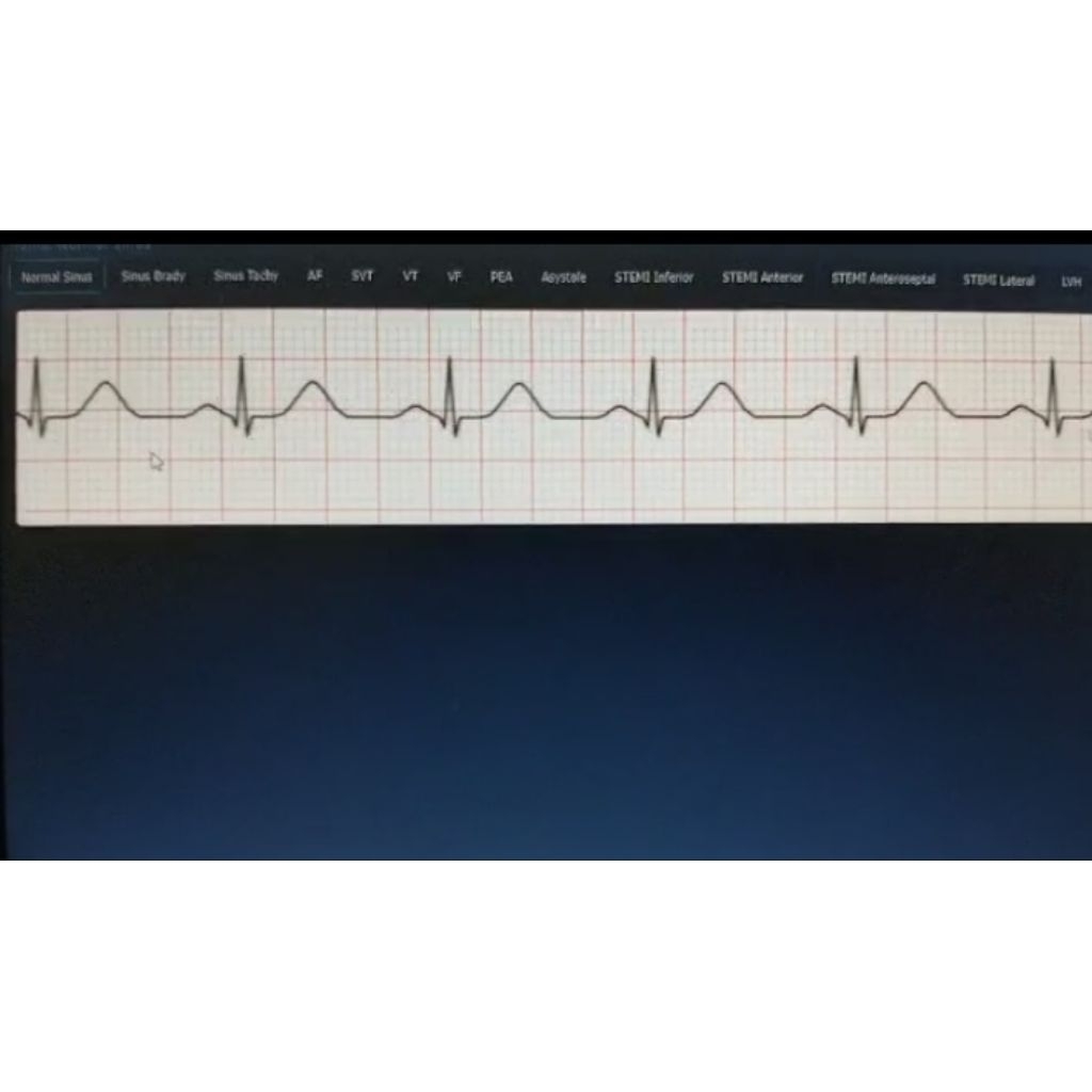 simulator ecg simulator ekg