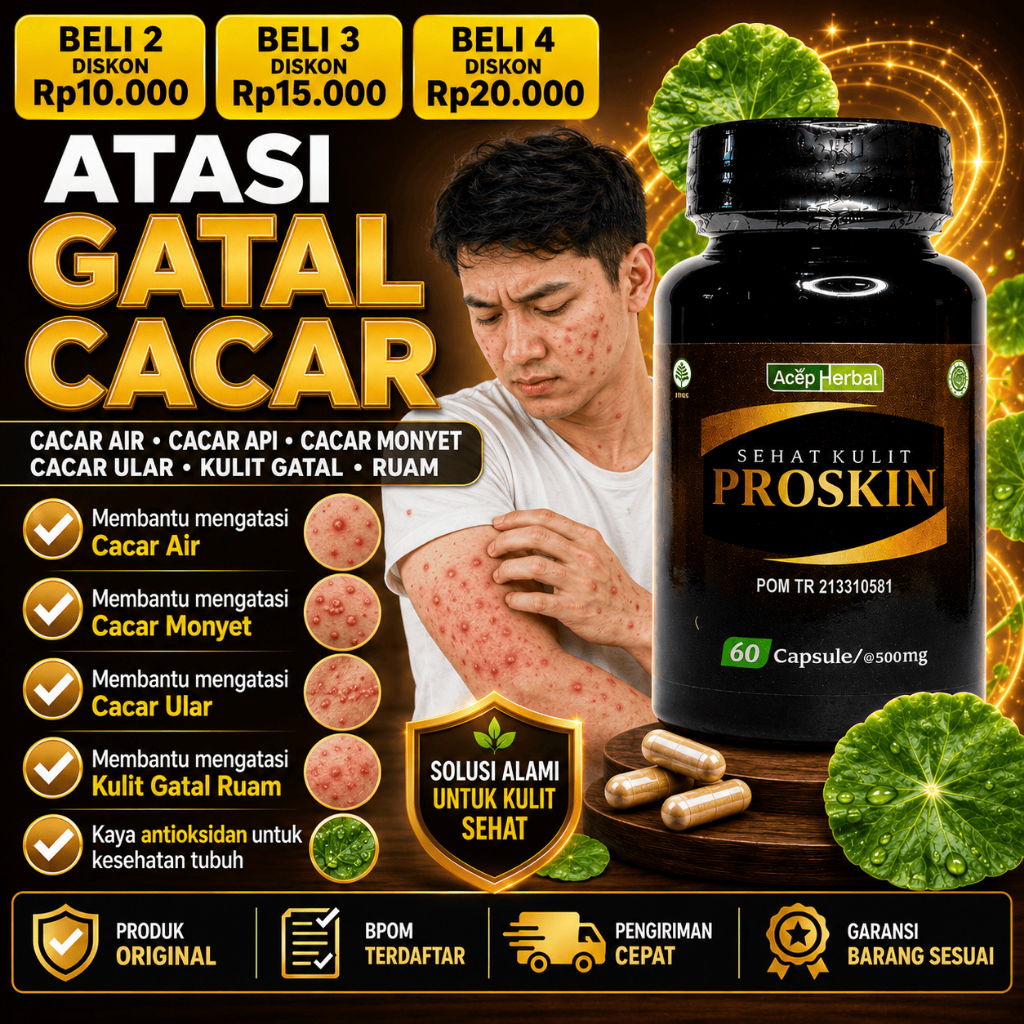 PROSKIN Obat Penghilang Cacar Gatal Cacar Air Cacar Api Cacar Monyet Cacar Ular Kulit Gatal Ruam