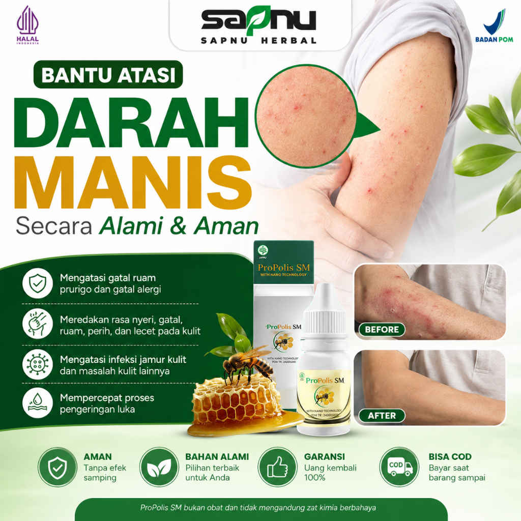 Obat Koreng, Obat Koreng Bernanah, Obat Bekas Koreng, Obat Darah Manis, Obat Gatal Koreng Bernanah, 