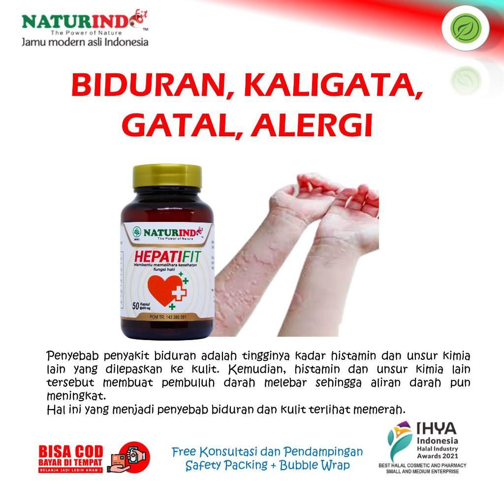 Biduran Gatal Gatal Kaligata Alergi