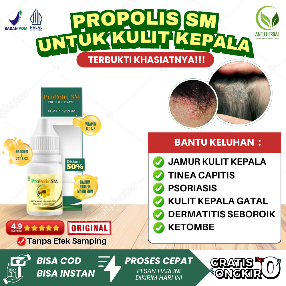 Penghilang Jamur di Kepala, Salep Tinea Capitis Obat Jamur Kulit Kepala, Psoriasis Kulit Kepala, Der