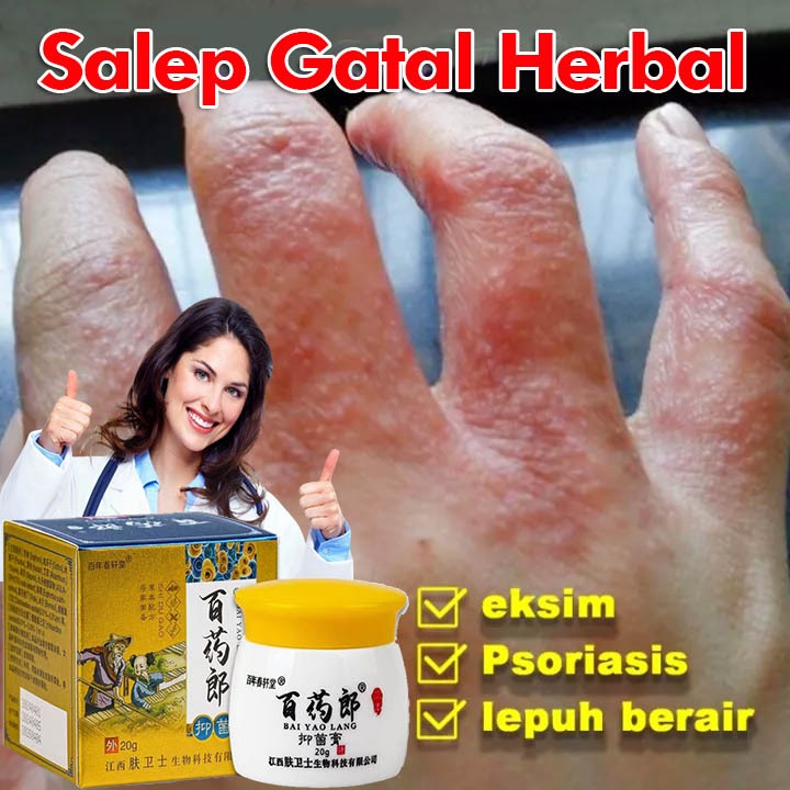 Salep Gatal Cina Paling Ampuh Salep Eksim Kering dan Gatal Salep gatal selangkangan Obat eksim Psori