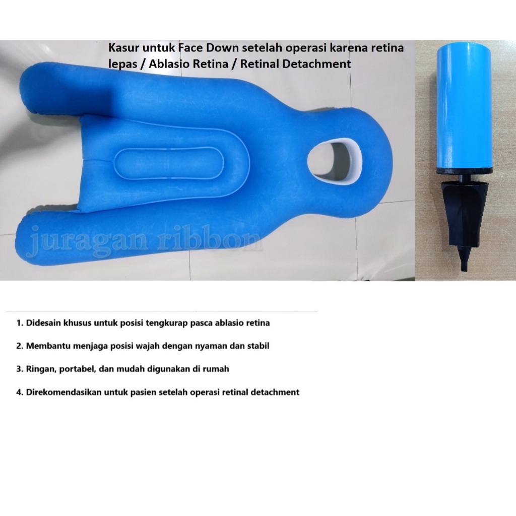 Ablasio retina / Retinal Detachment kasur untuk face down pillow