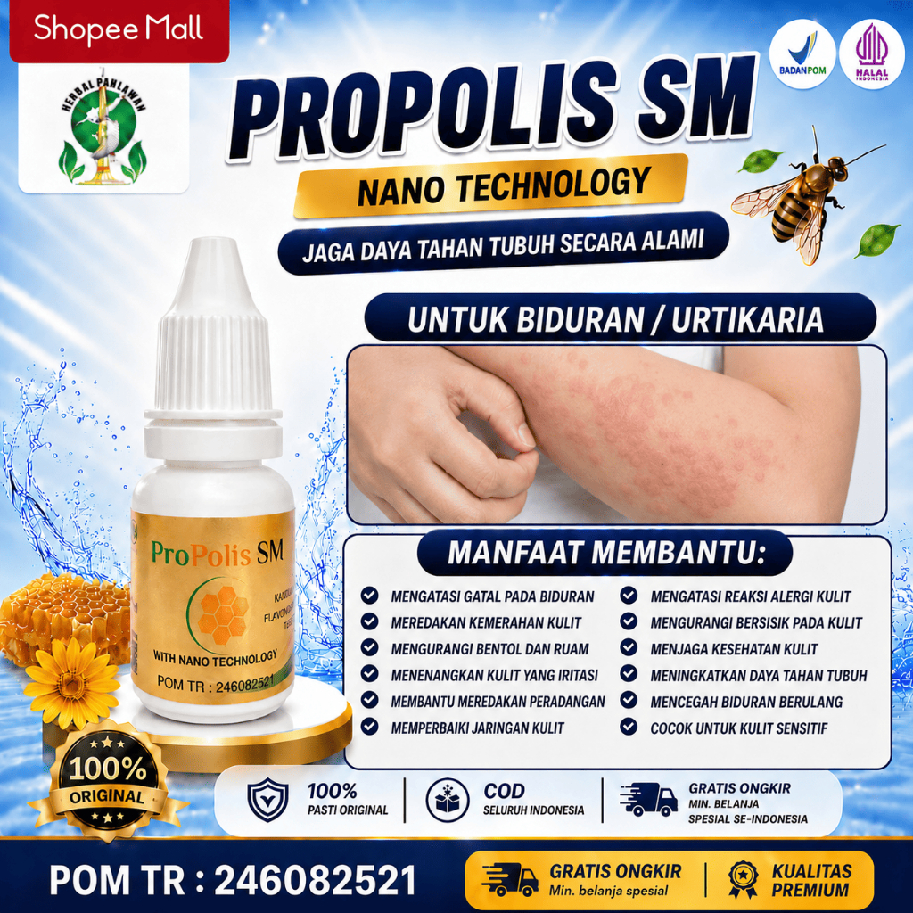 Obat Untuk Biduran / Urtikaria, Mengatasi Gatal Pada Biduran, Mengurangi Bentol Dan Ruam - Propolis 