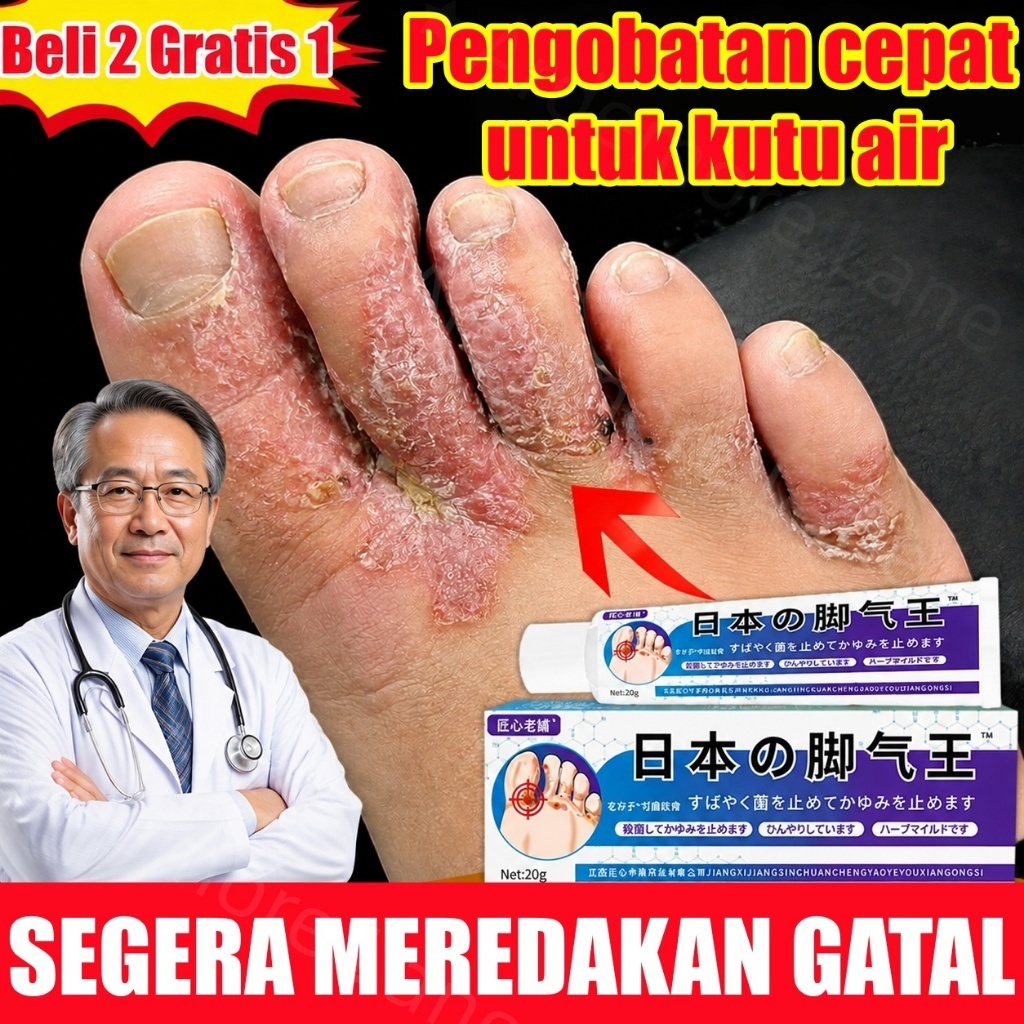 Jepang Salep jamur kaki Salep kaki rayapan dan bau salep kaki gatal jamur obat jamur kaki salep bau 