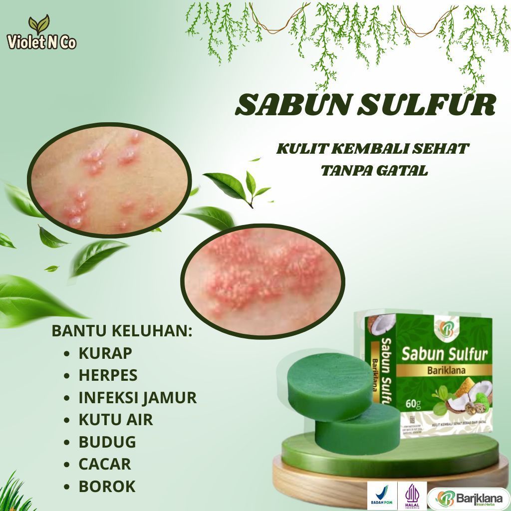 Sabun Sulfur - Obat Cacar, Luka Cacar, Bopeng Bekas Cacar, Gatal Cacar, Cacar Bernanah, Cacar Di Sel
