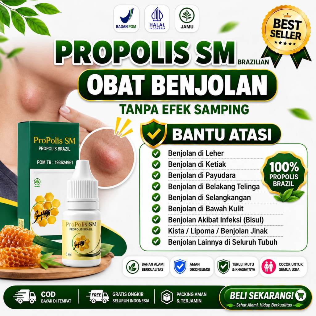 Obat Propolis SM untuk Penghilang Keloid Menonjol
