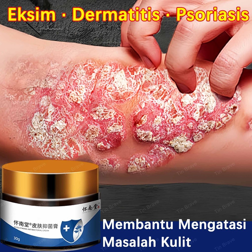 salep gatal china salep eksim kering dan gatal paling ampuh obat salep gatal selangkangan salep psor