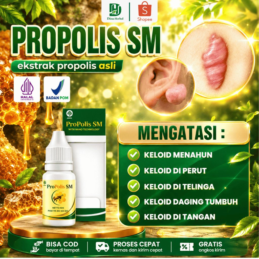 Obat Keloid, Keloid Menahun, Keloid Luka Tindik, Keloid Di Perut, Keloid Di Telinga, Keloid Daging T