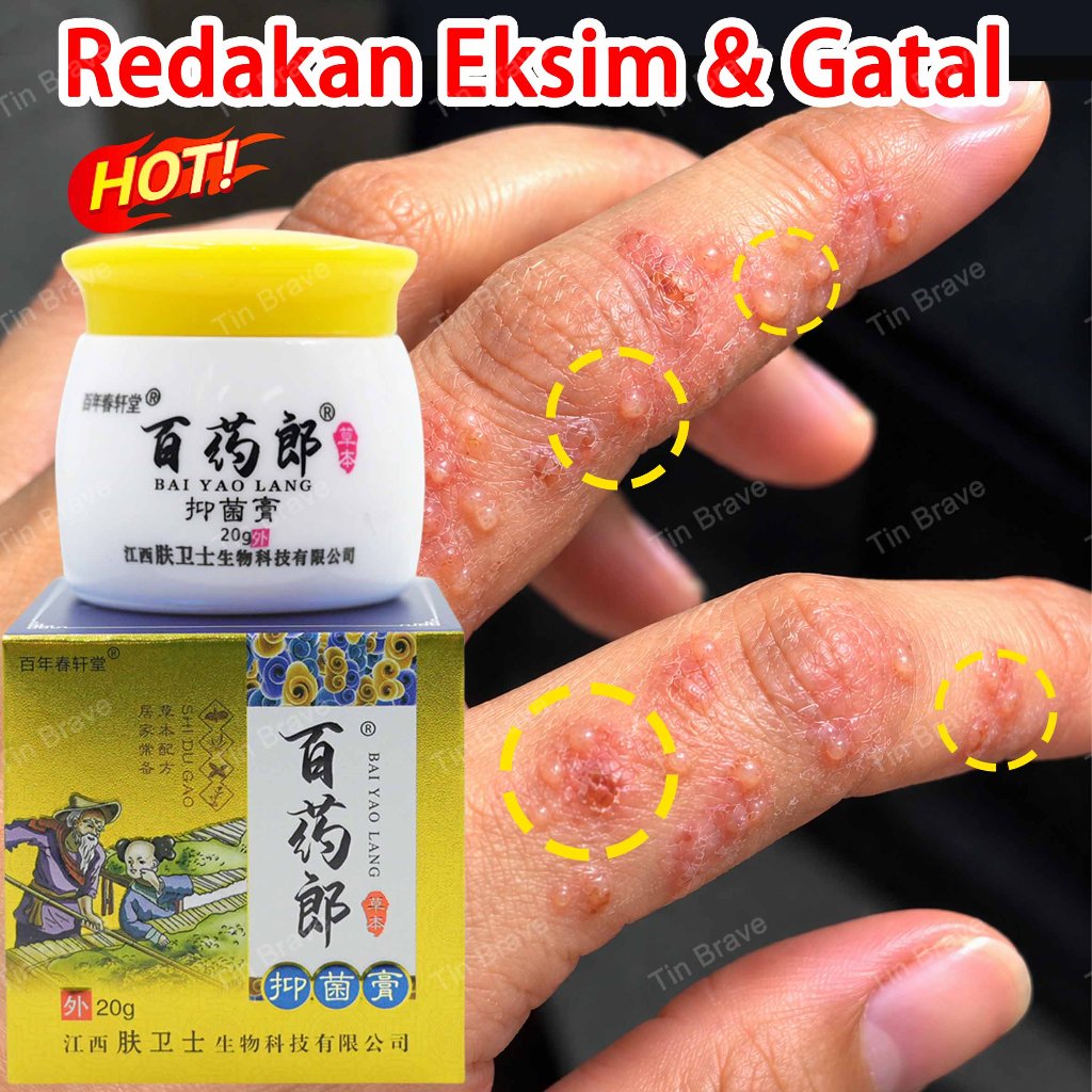 salep gatal anti jamur salep gatal eksim paling ampuh salep gatal selangkangan psoriasis cream obat 