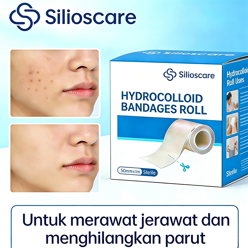 SiliosCare Hydrocolloid Acne Patch Roll 50mm×1m Plester Jerawat Anti Jerawat Menyerap Cairan Jerawat Bisa Dipotong Sesuai Kebutuhan