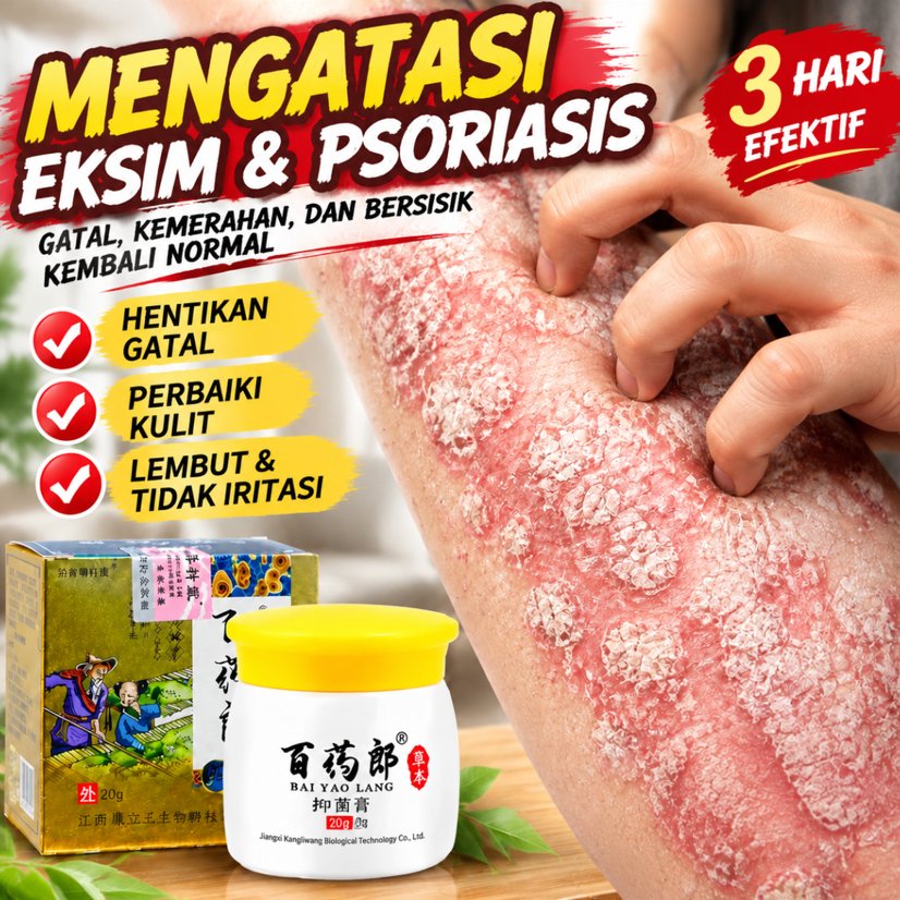 Salep Gatal China Paling Ampuh Salep Gatal Jamur Selangkanga Krim Eksim Bayi Dan Obat Kurap Obat Gat