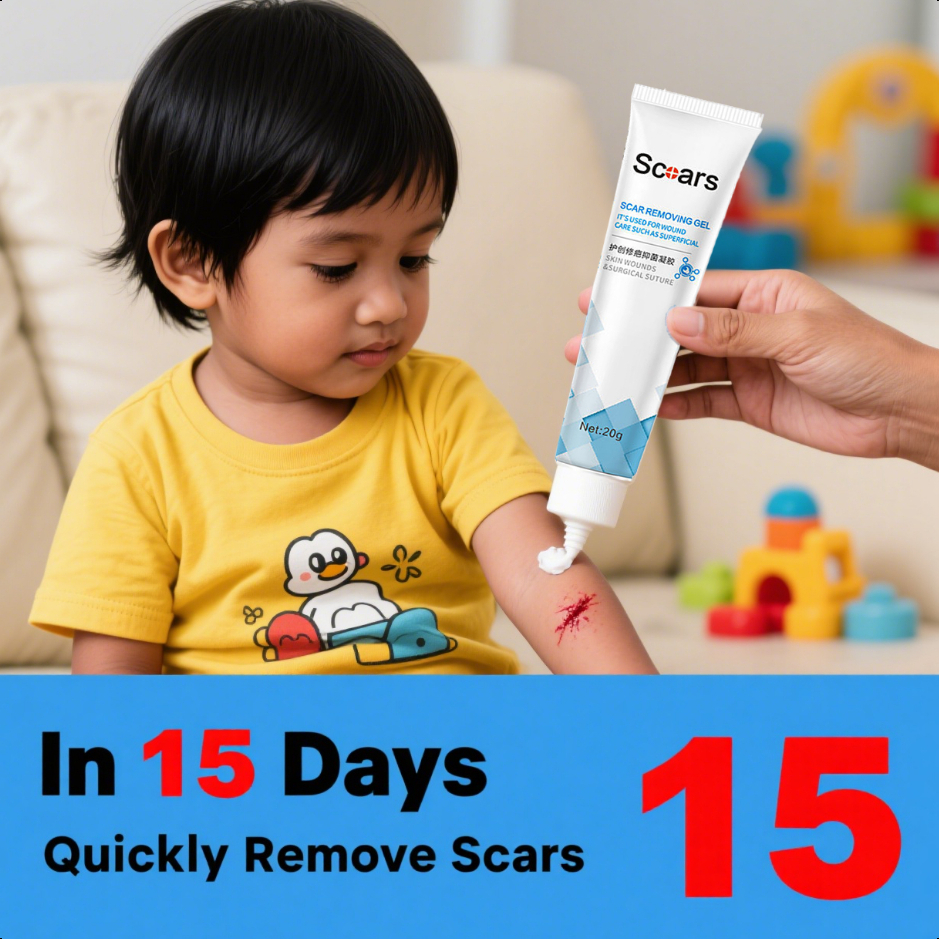 Penghilangan bekas luka anak Penghilang bekas koreng lama Penghilang bekas koreng hitam Penghilang b