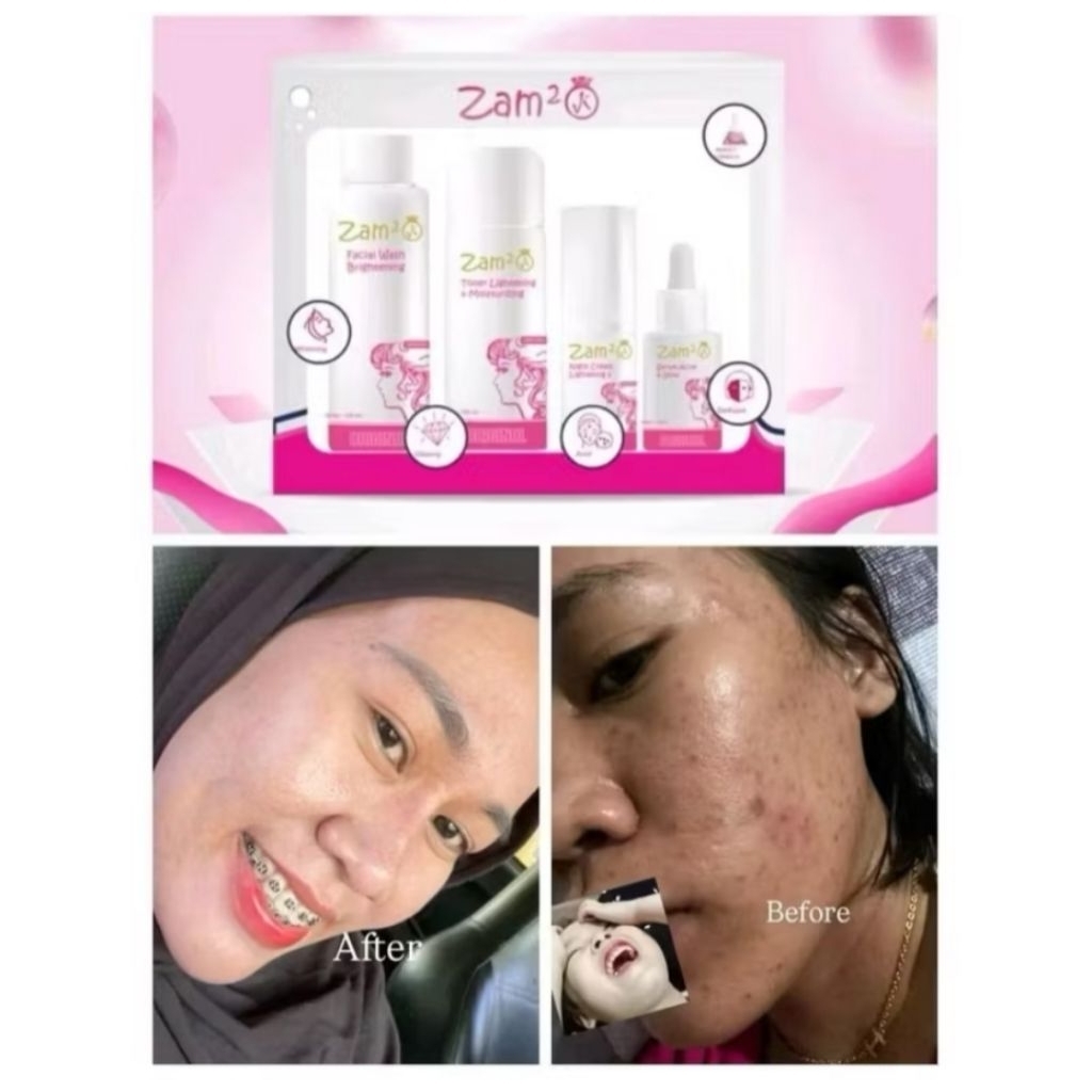 SKINCARE ZAMZAM BPOM ORIGINAL KEMASAN BARU