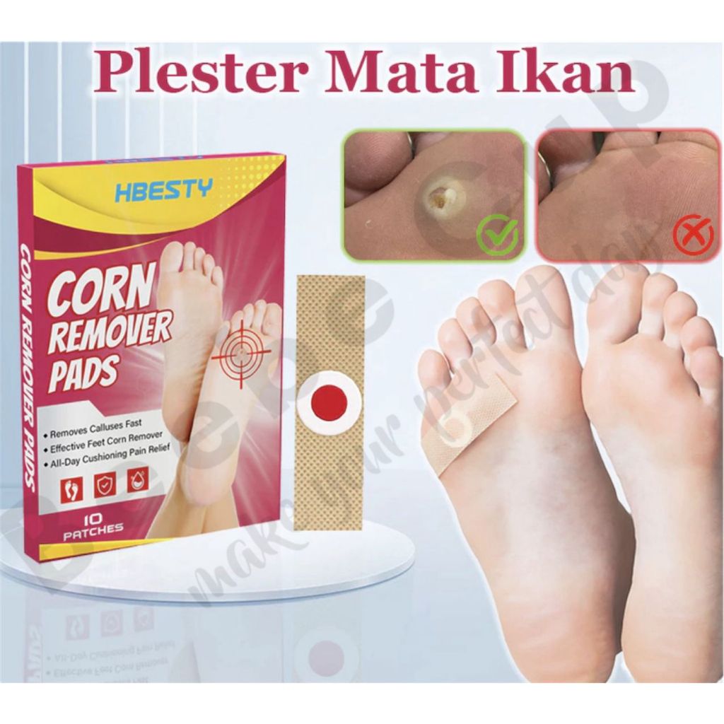 Plester Mata Ikan Paling Ampuh Obat Mata Ikan Penghilang Mata Ikan Plester Kutil Dan Mata Ikan Foot 