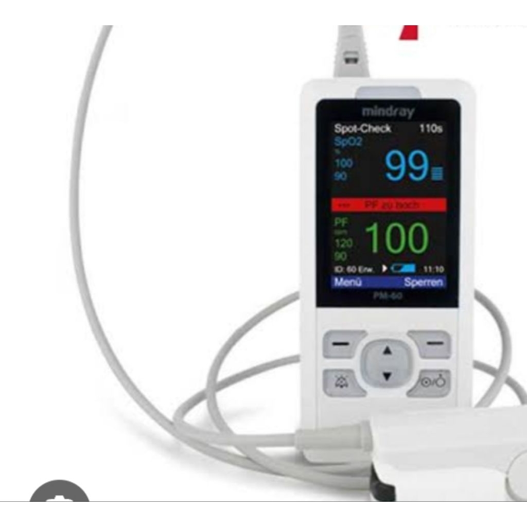 saturasi oksigen bayi dan anak