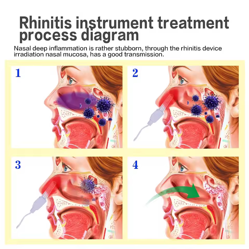 PWR FM BIONASE ALAT TERAPI SINUSITIS RHINITIS HIDUNG PILEK