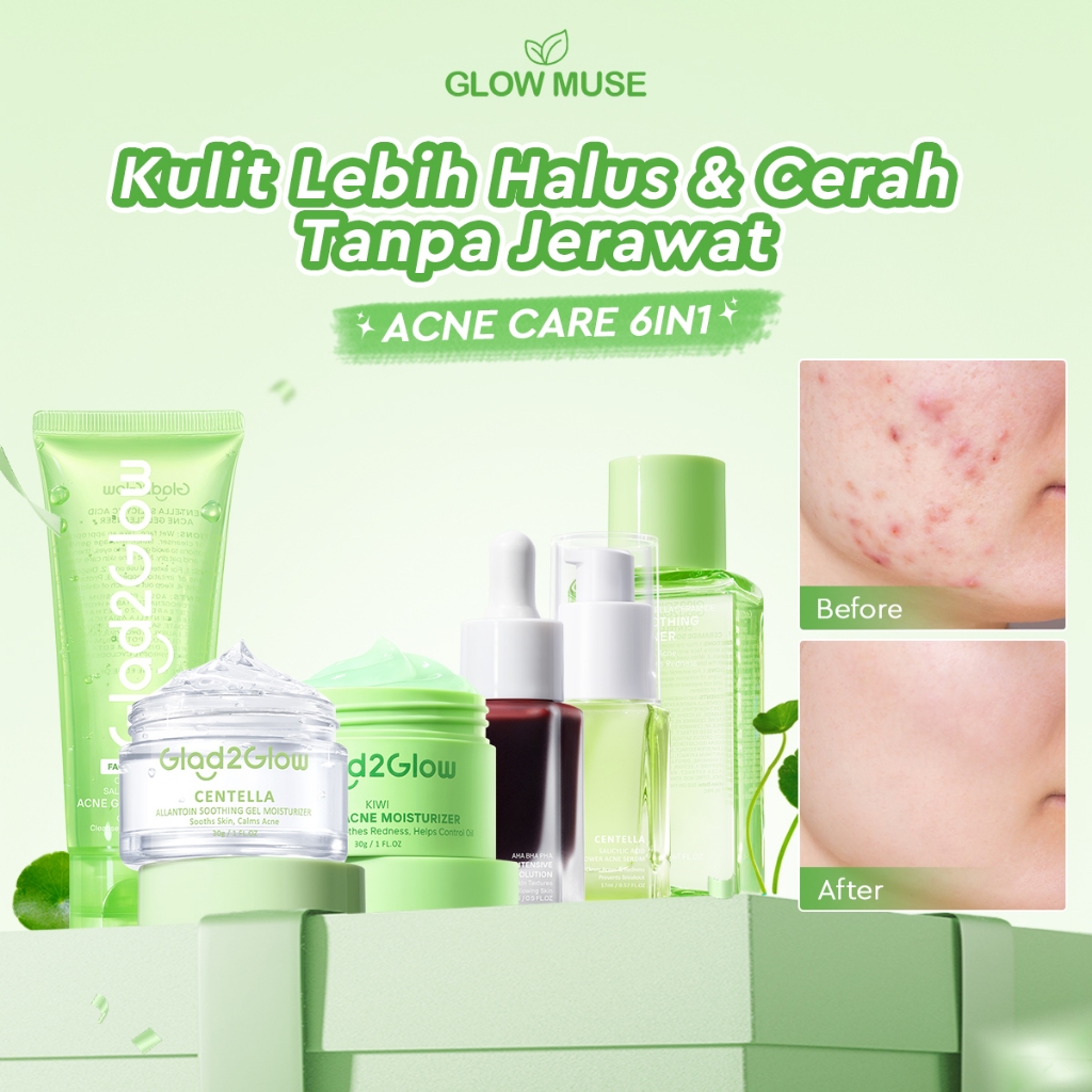 [100% ORI] Glad2Glow Acne Jerawat bundle all in 1 - 3/4/5/6 PCS Skincare Paket-Soothing toner+Centel