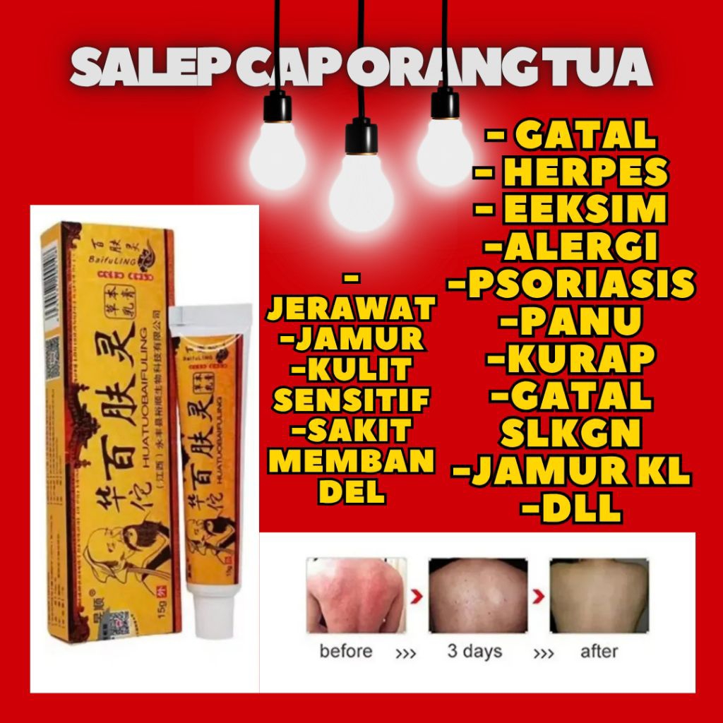 Salep Gatal Cina CAP ORANG TUA Ampuh ORIGINAL