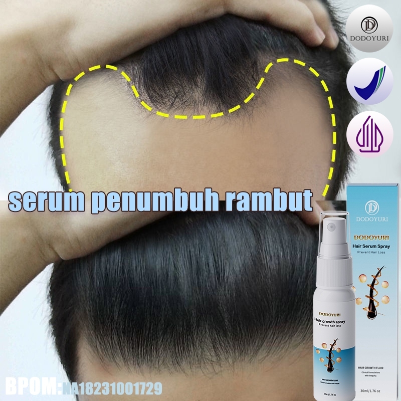【BPOM】Serum penumbuh rambut penumbuh rambut botak penebal rambut penumbuh rambut cepat 30ml hair ton