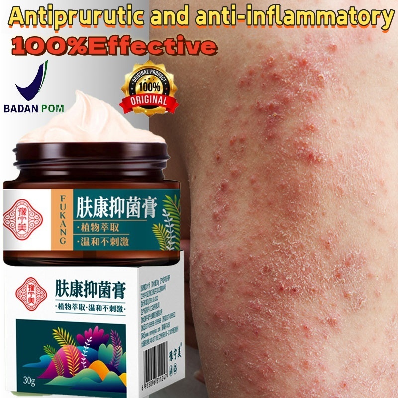 Salep Anti Gatal Eksim, Salep Kurap Obat Anti Gatal Eksim Salep psoriasis paling ampuh Tinea capitis