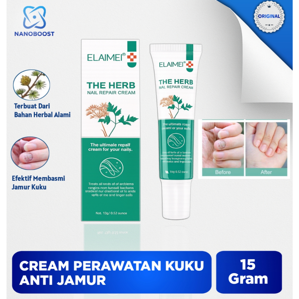 Krim Obat Kuku Jamur Herbal Elaimei 15gr – Atasi Kuku Rapuh, Menguning & Pecah