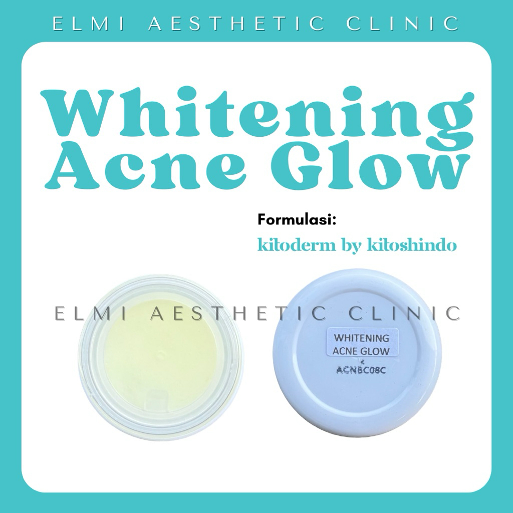 KITODERM WHITENING ACNE GLOW | CREAM MALAM WHITE ACNE GLOW