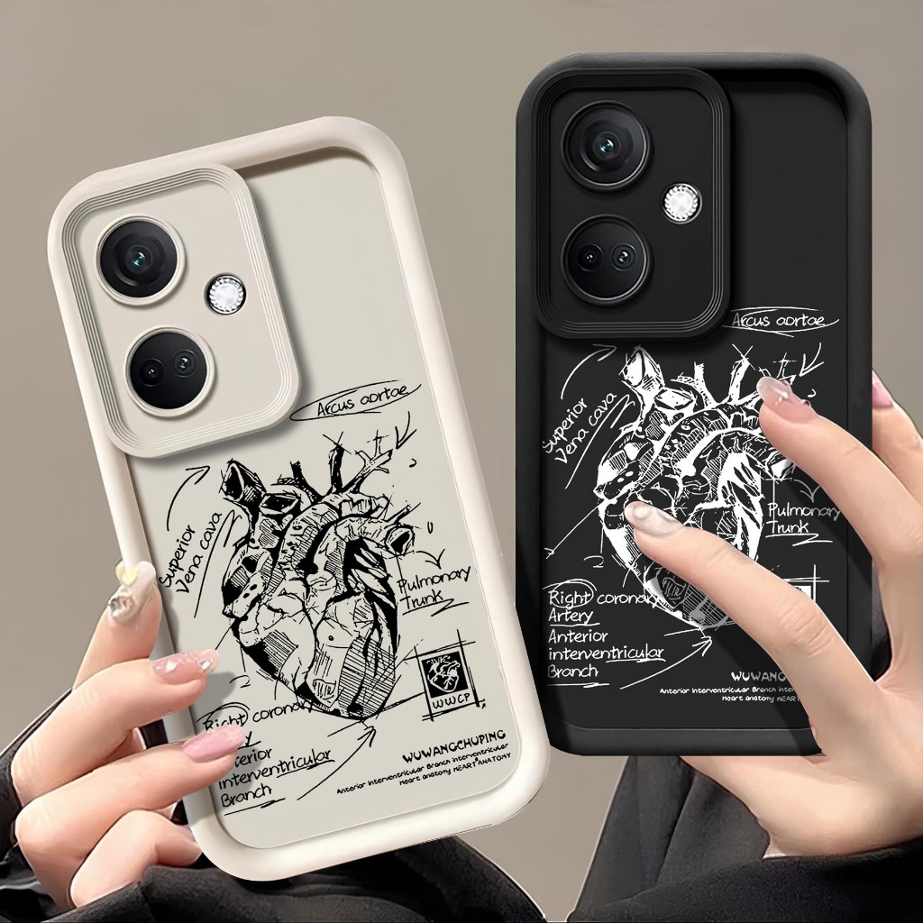 Softcase Rubber Oppo A3x - Case Hp Oppo Oppo A3x - Softcase Pro Camera Oppo a3x - Case Timbul Oppo O