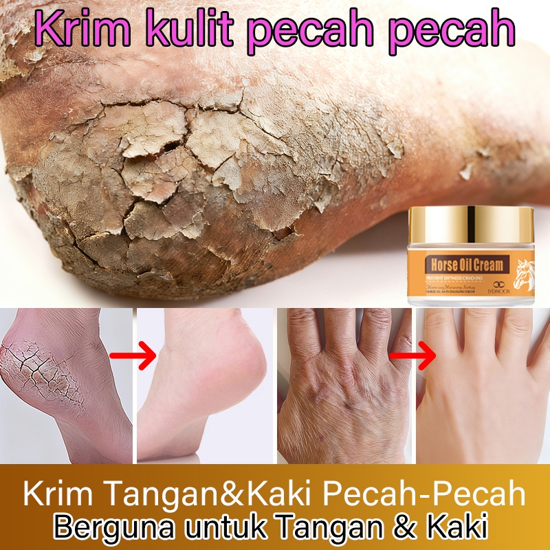 cream kaki dan kering foot cream Krim pelindung pecah2 tangan&kaki paling efektif krim kaki Obat kak