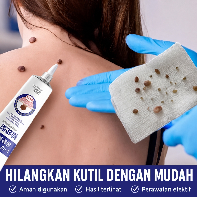 Salep Kutil Paling Ampuh Obat Kutil Penghilang Tahi Lalat Wajah 0bat Kutil Ampuh Ori Calusol Kutil O