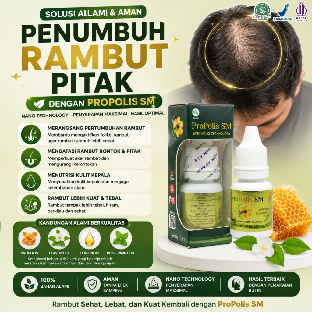 Obat Penumbuh Rambut Pitak Alopecia Areata Botak Koin Kerontokan Rambut Menipis Rontok Kerusakan Pad