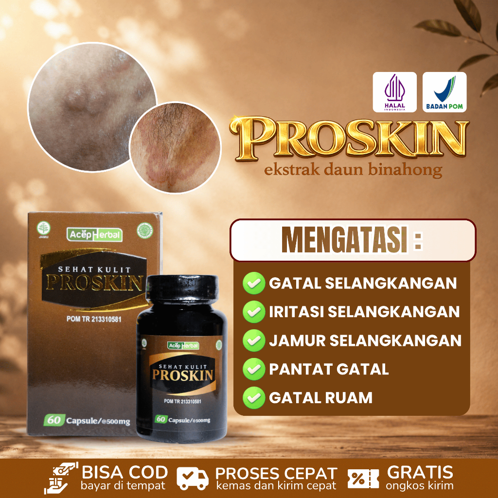 Obat Gatal Selangkangan Pria Dan Wanita, Obat Iritasi Pada Selangkangan, Obat Selangkangan Berjamur,