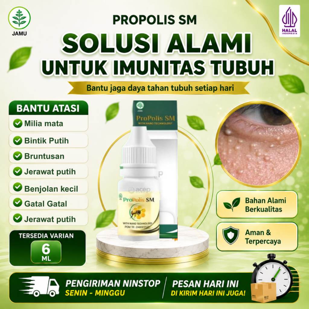 Obat Milia, Tetes Milia, Milia Dibawah Mata,  Milia Hitam, Milia Di Wajah, Penghilang Milia,  Milia 