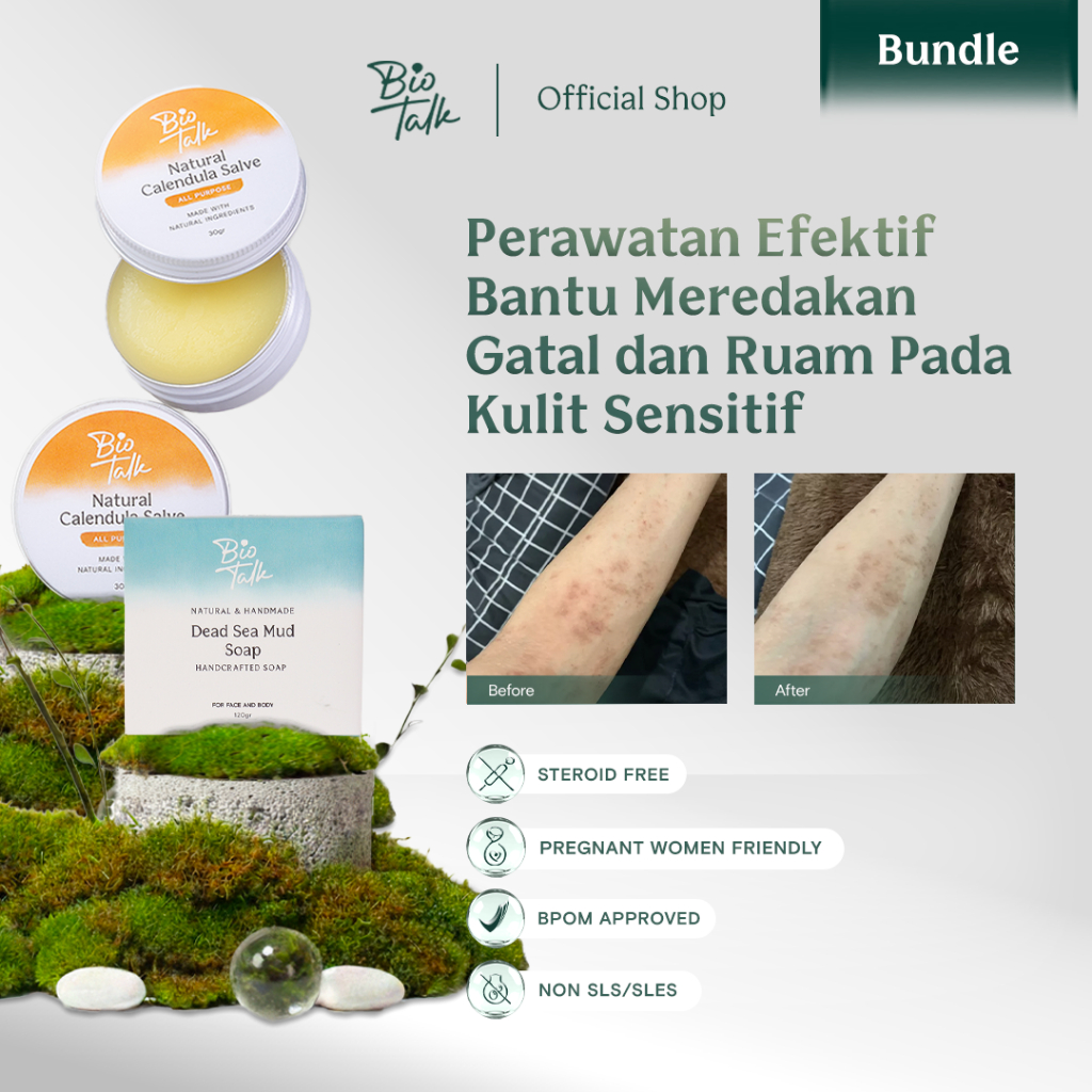Biotalk Bundle Gatal dan Ruam | Salep Sabun Melembapkan Bagus Untuk Kulit Gatal Alergi Iritasi Ruam