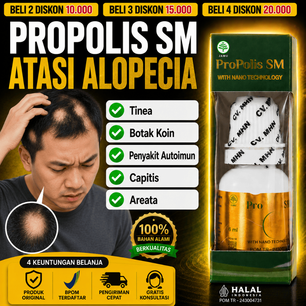 PROPOLIS SM Obat Alopecia Areata Botak Koin Penumbuh Rambut Pitak Penyakit Autoimun Tinea Capitis