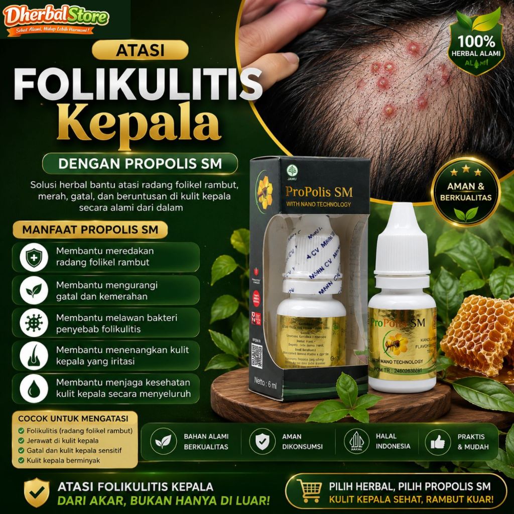 Obat Folikulitis Radang Folikel Rambut Jerawat di Kepala, Obat Jamur Kepala, Obat Psoriasis Kulit Ke