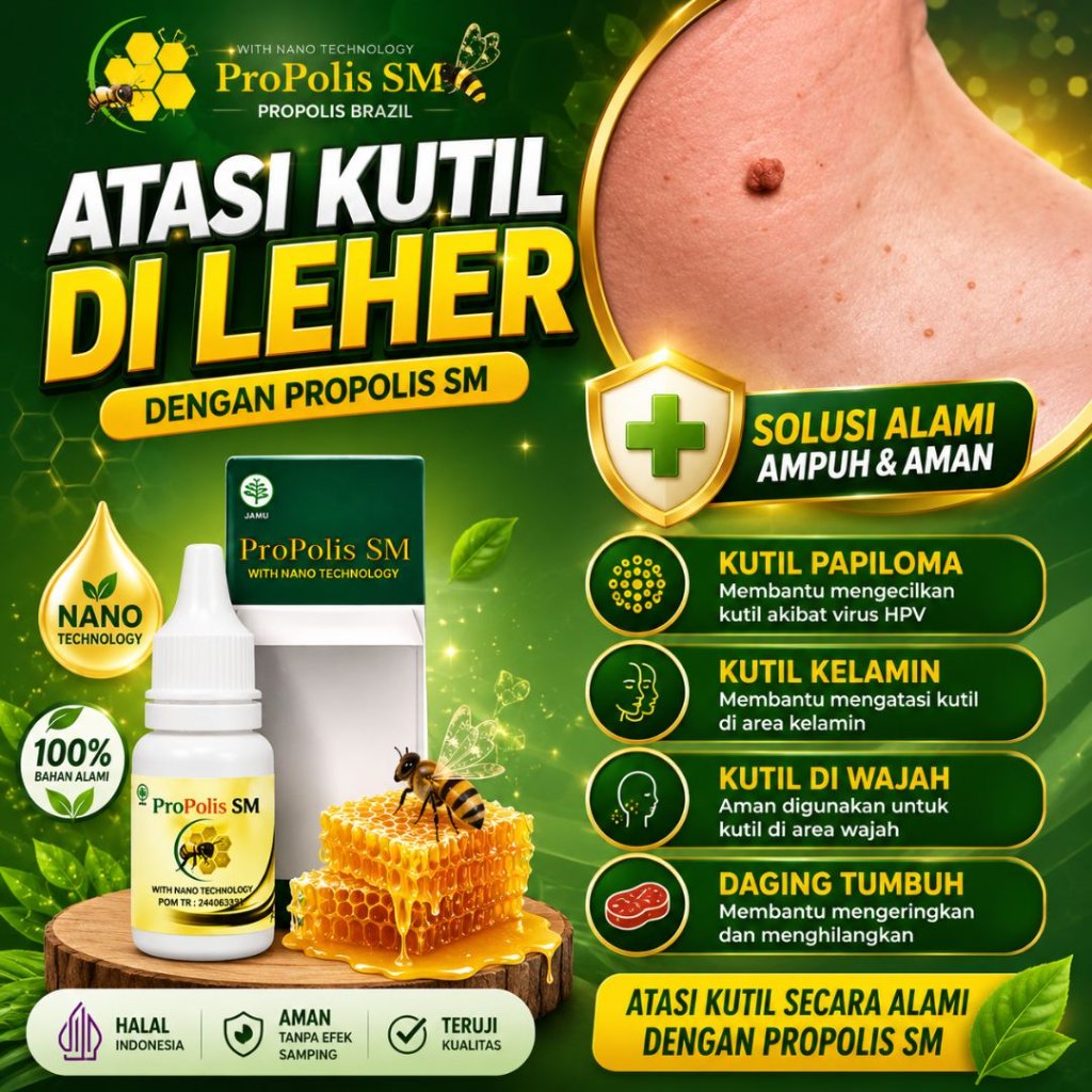 Obat Tetes Kutil di Leher, Kutil Papiloma, Kutil Kelamin, Kutil di Wajah, di Tangan Kaki Atasi Denga