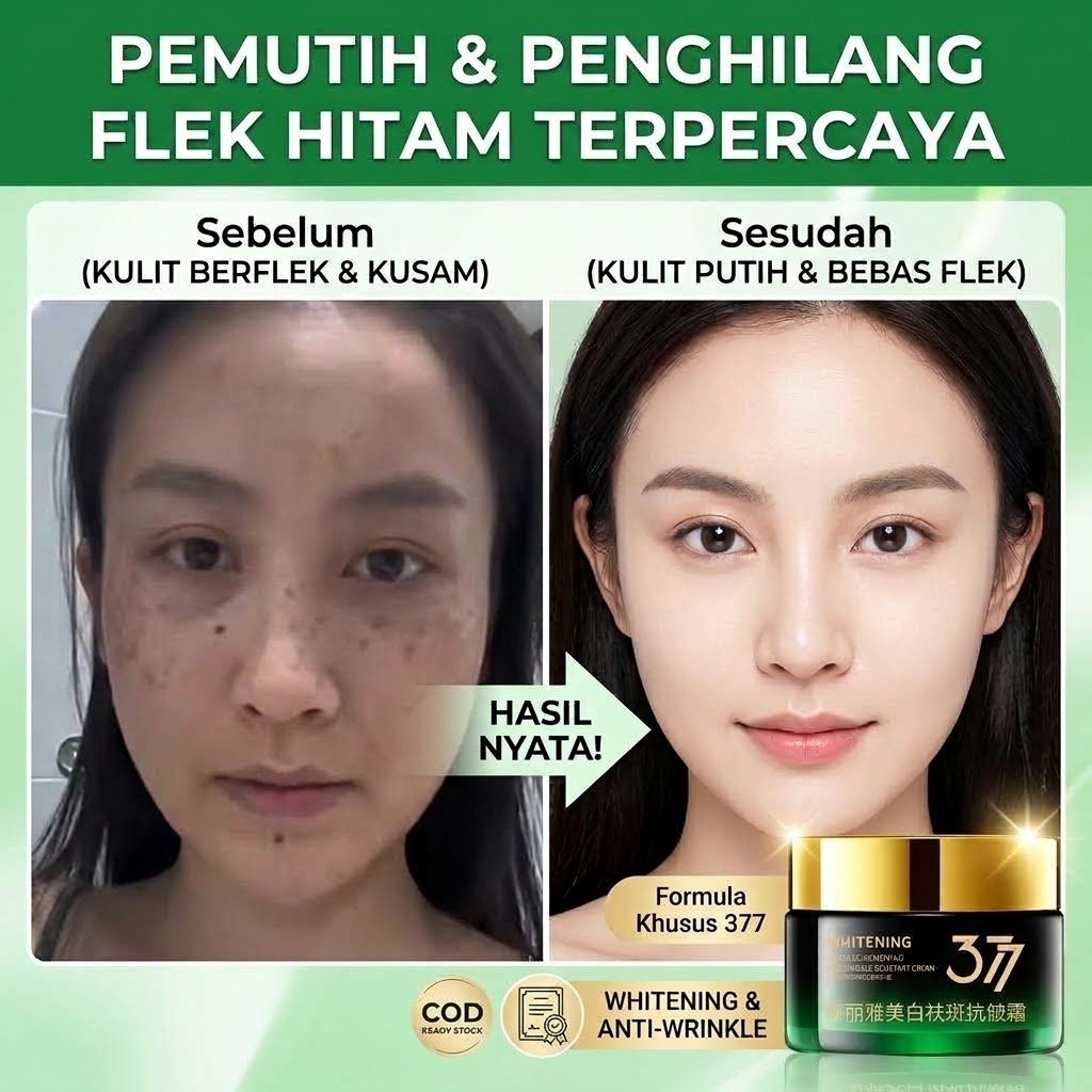 [BPOM COD] Krim Pemutih Wajah Glowing 30g 377 Cream Flek Hitam Membandel Ampuh Salep Penghilang Flek