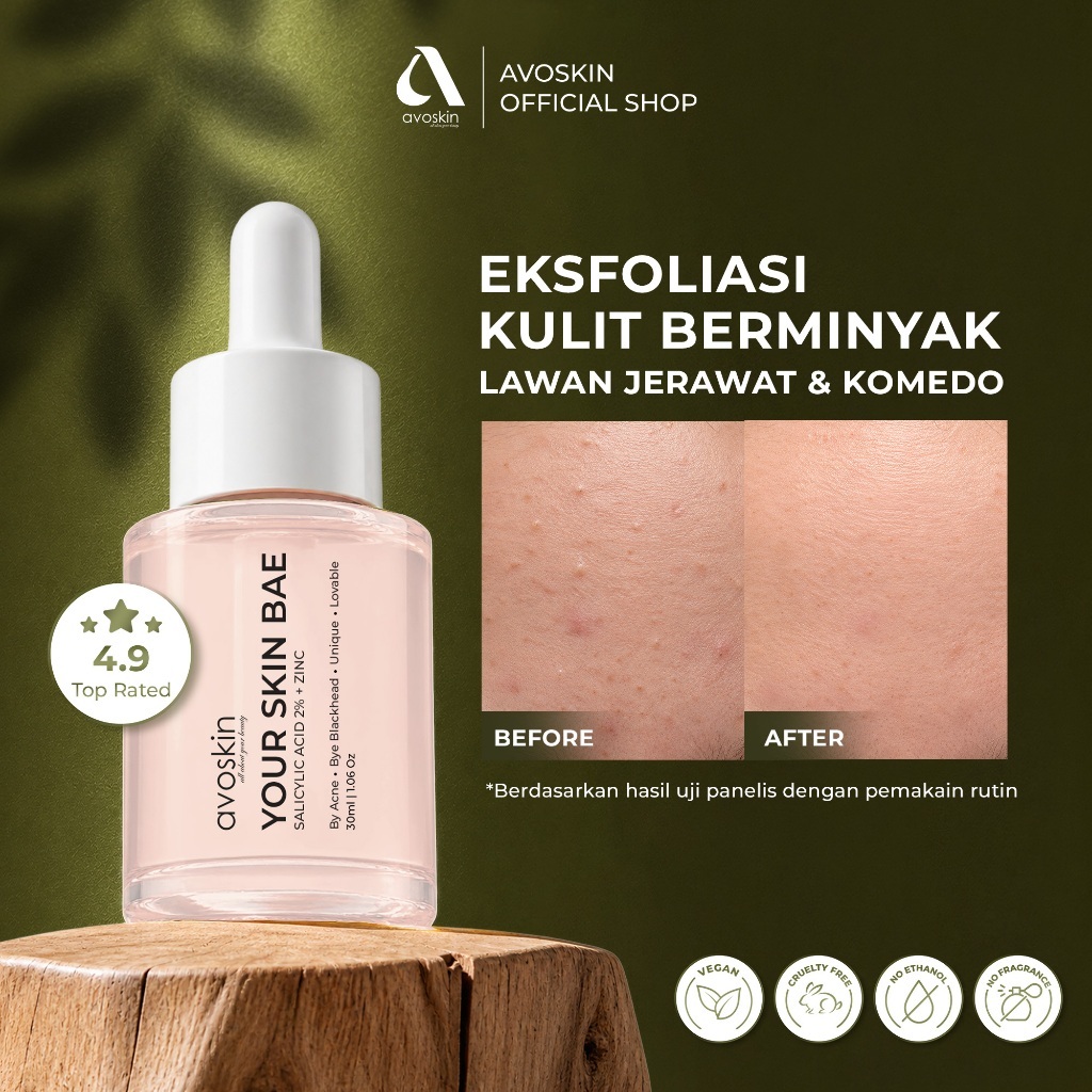 AVOSKIN - Your Skin Bae Salicylic Acid Serum 30ml | 2% Salicylic Acid + Zinc | Targeted BHA Pore Car