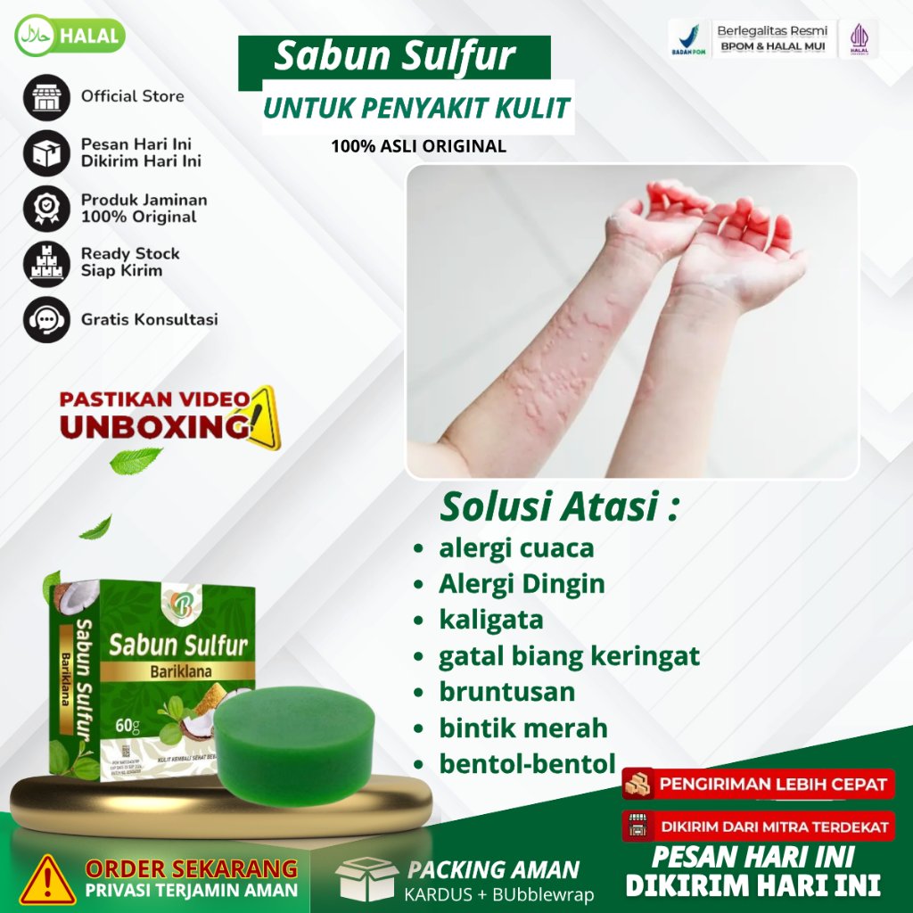 Sabun Sulfur Bariklana - Atasi Alergi Cuaca, Alergi Dingin, Kaligata, Gatal Biang Keringat, Bruntusa