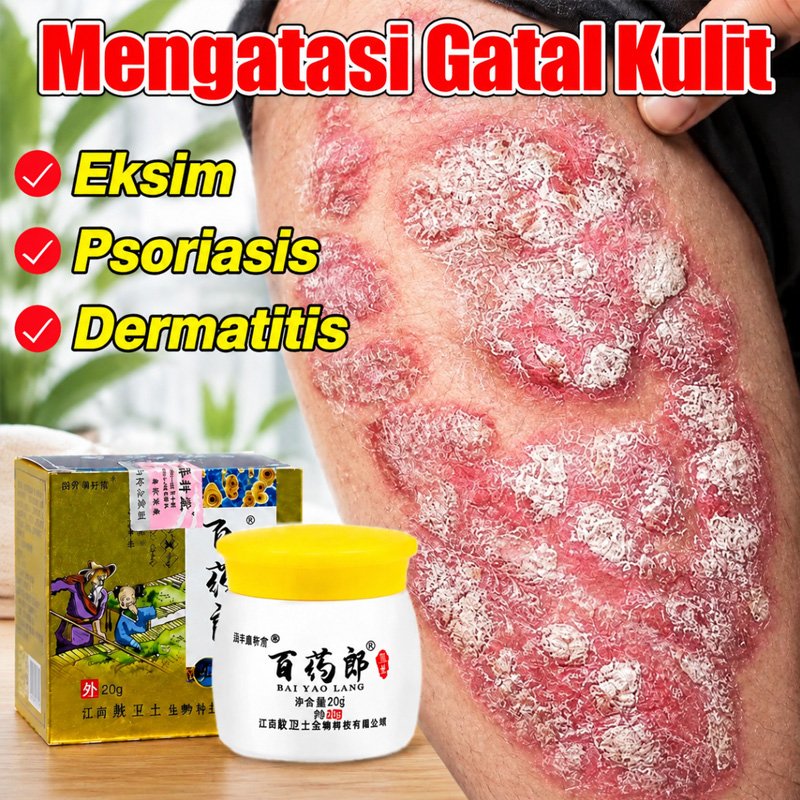 Salap gatal china salep eksim kering dan gatal salep china gatal paling ampuh salep gatal selangkang