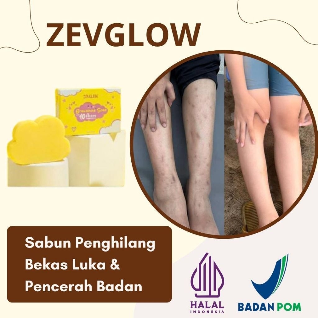 ZEVGLOW WHITENING SOAP (SABUN PEMUTIH BADAN & WAJAH) SABUN PENGHILANG BEKAS LUKA