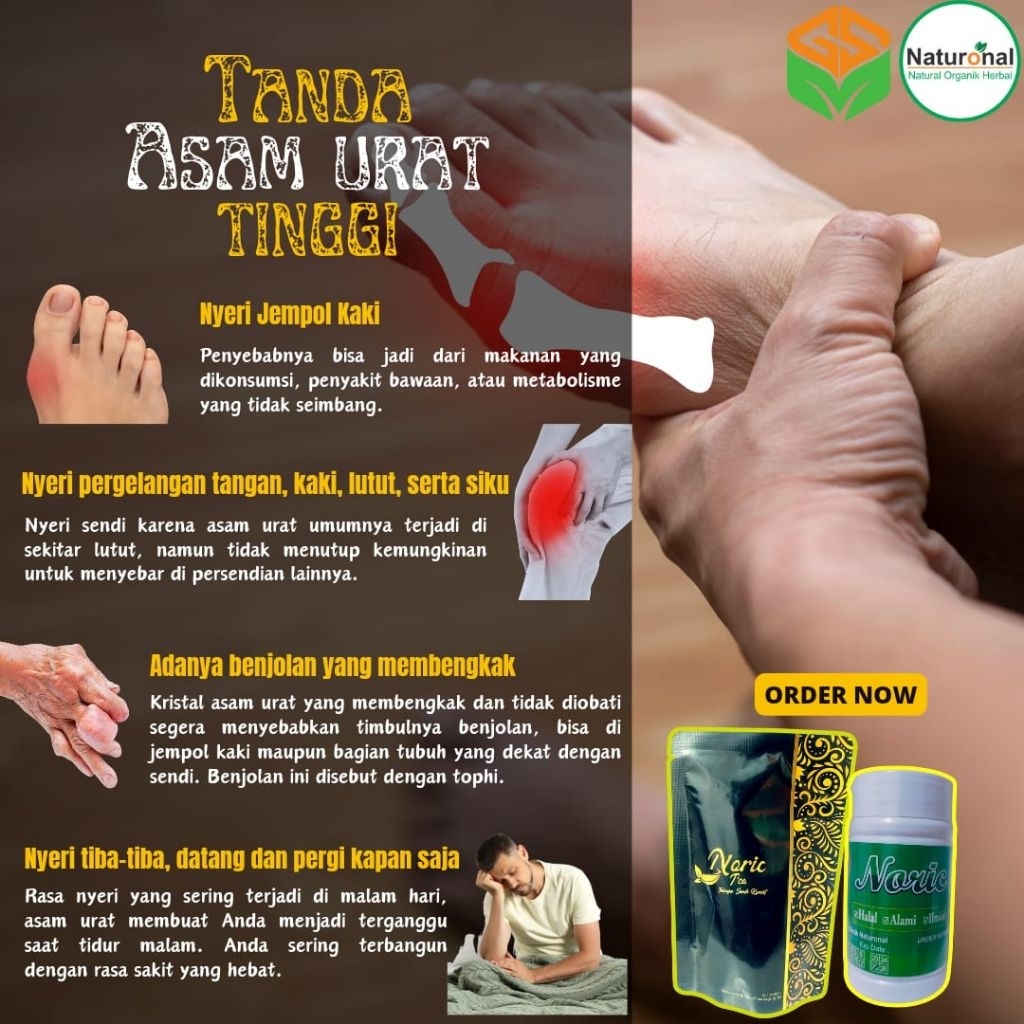 

NORIC Herbal Asam Urat, Kebas-kebas, Kesemutan, Kaki Pegal, Telapak Panas