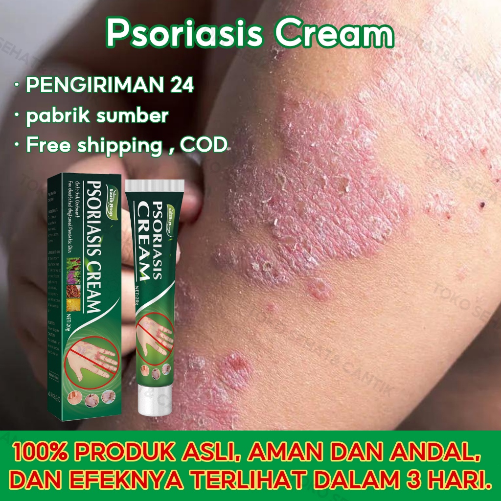 South Moon Psoriasis Cream 20g Salep Eksim Salep Psoriasis Krim Anti Eksim Cepat Redakan Gatal Gatal
