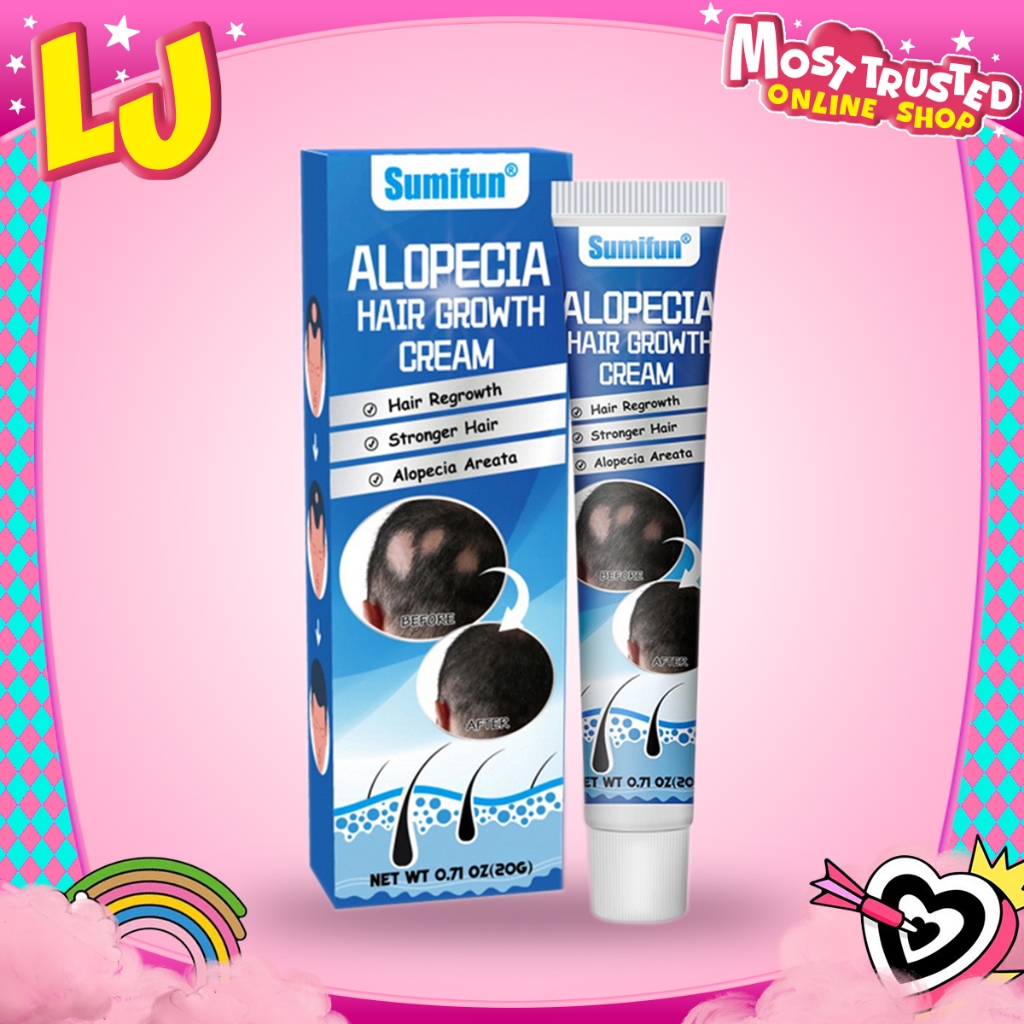 Obat alopecia areata, obat penumbuh rambut cepat