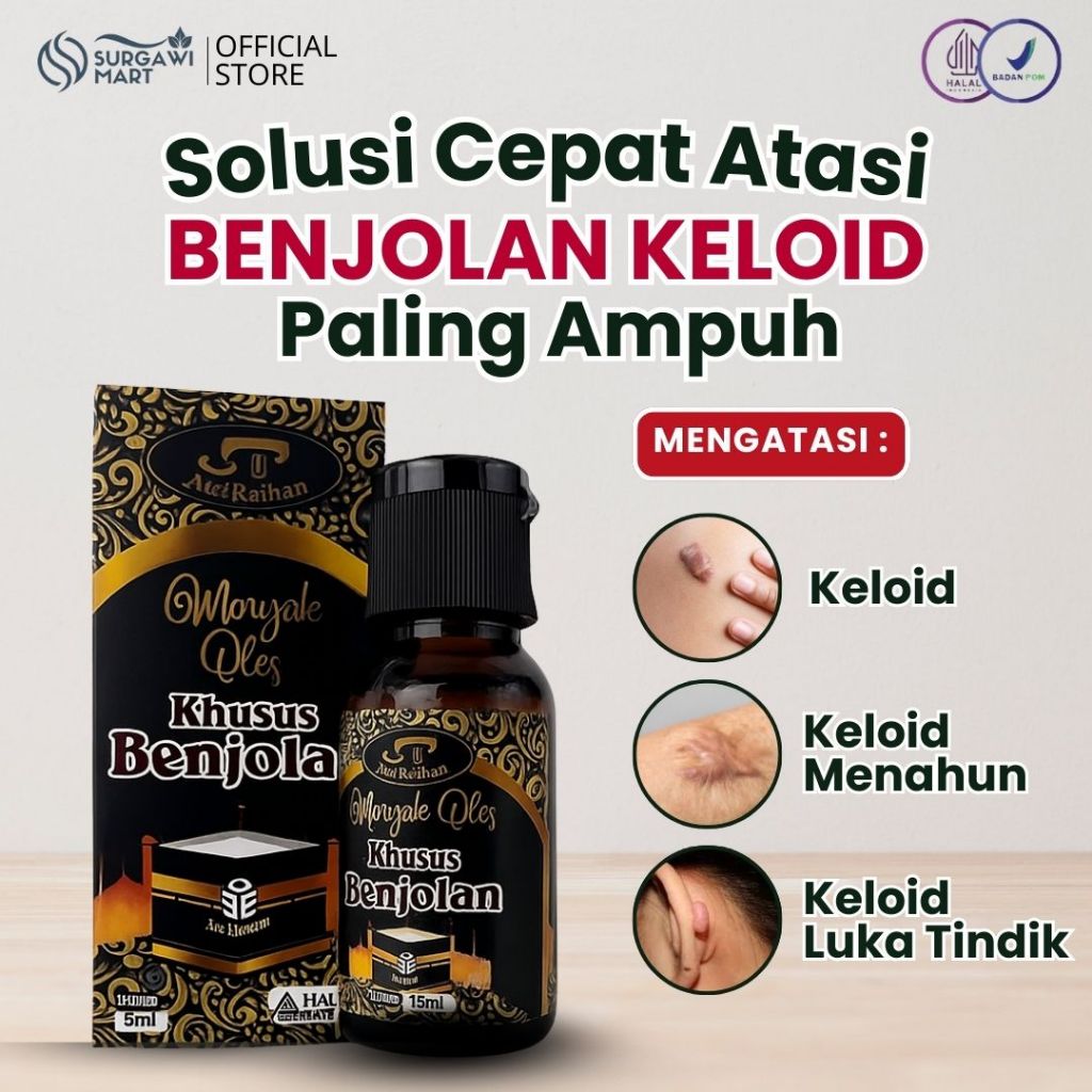 Minyak Oles Benjolan – Obat Oles Pengempis Benjolan Keloid Paling Ampuh