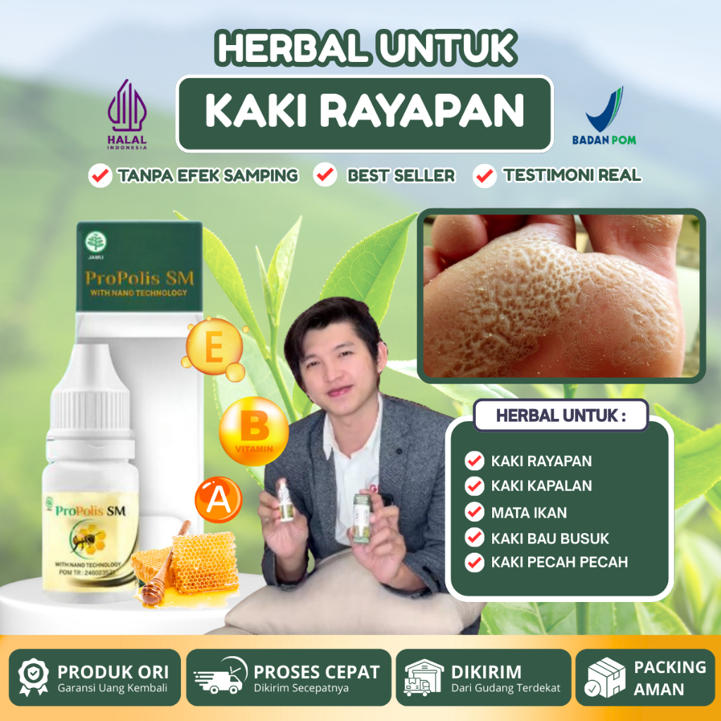 Obat Kaki Rayapan bau kaki, Kaki Berlubang Bolong, kaki pecah dan kering Infeksi Telapak kaki bolong